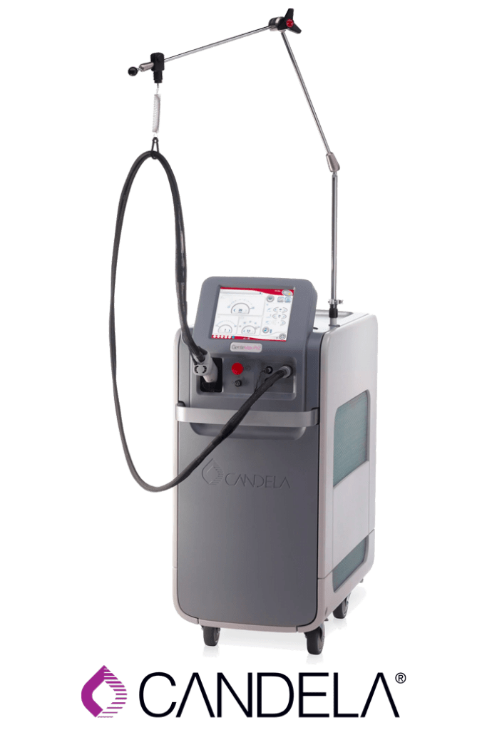 Laser Hair Removal Birmingham Sutton Coldfield