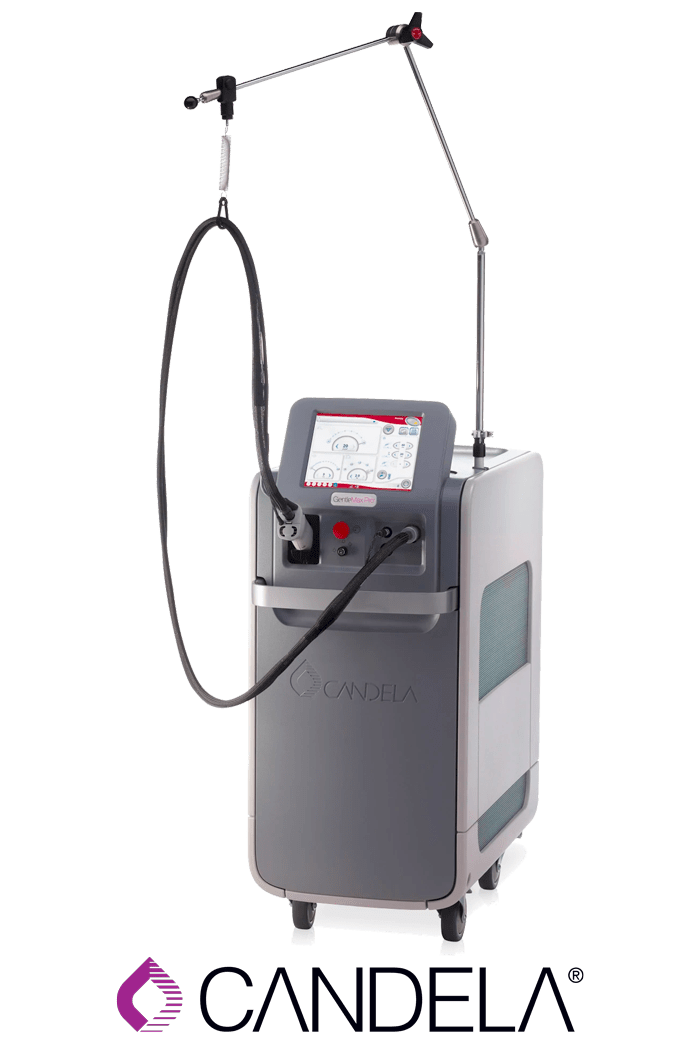 Laser Hair Removal Birmingham Sutton Coldfield