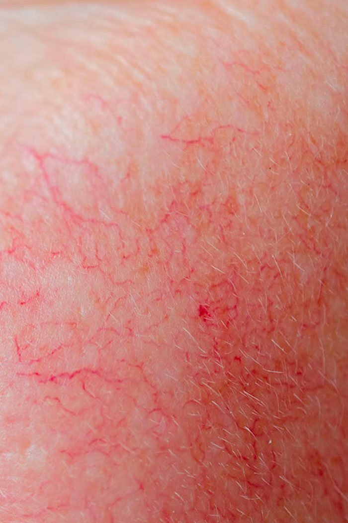 ThreadVeins