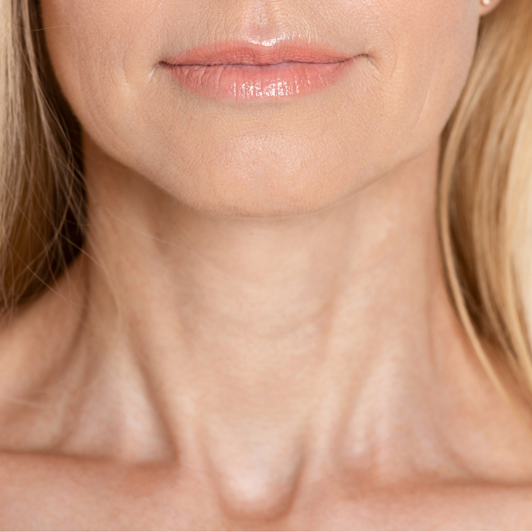 Neck Lift Surgery Victoria House Clinic