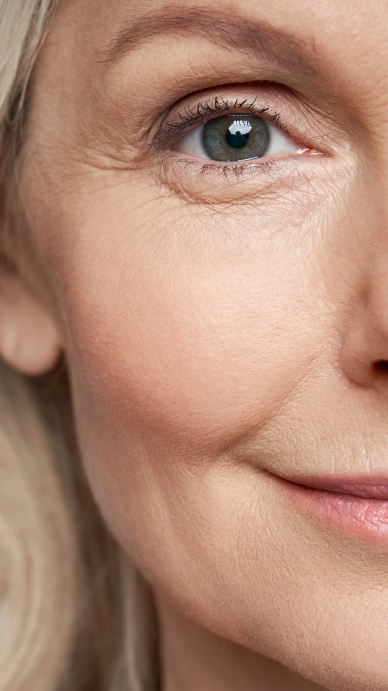 Blepharoplasty at Victoria House Clinic