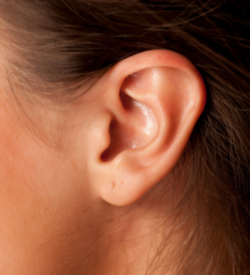 Earlobe correction Earlobe correction