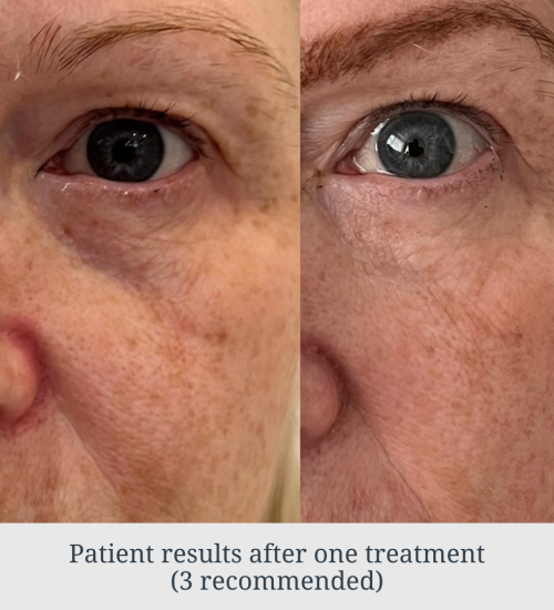 Stock Images – New Treatments (36) Stock Images - New Treatments (36)