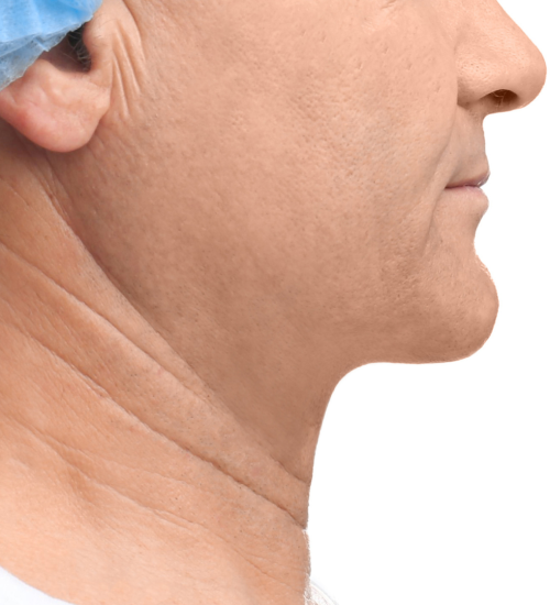 Stock Images – New Treatments (46) Stock Images - New Treatments (46)