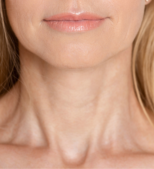 Neck Lift Victoria House Clinic Neck Lift Surgery Victoria House Clinic