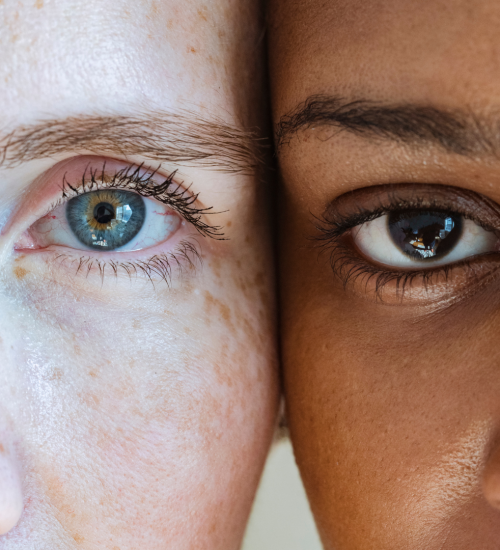 Eyelid surgery Eyelid surgery